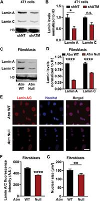 ATM Modulates Nuclear Mechanics by Regulating <mark class="highlighted">Lamin A</mark> Levels
